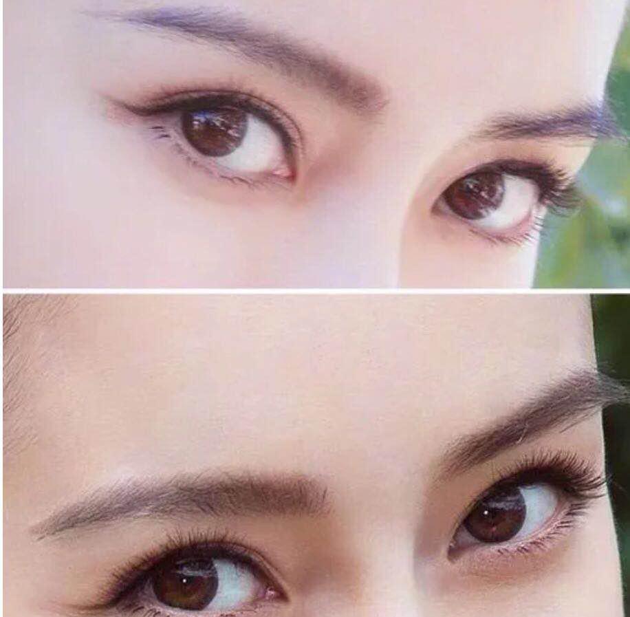 不要羡慕别人的眼皮,不要羡慕眼睛大的人