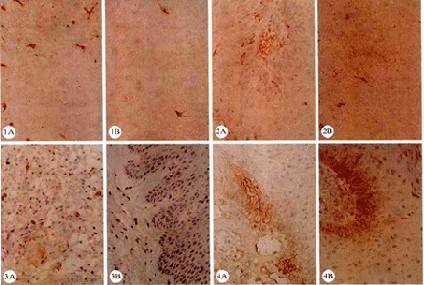 妻子感染hpv说明丈夫肯定有外遇,夫妻之间怎么防止感染hpv