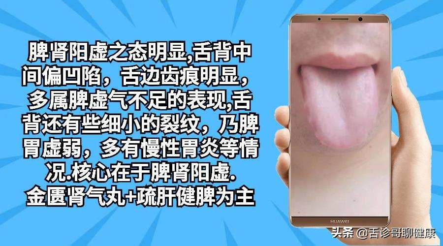 舌诊哥聊血瘀,舌诊哥聊健康肝胆