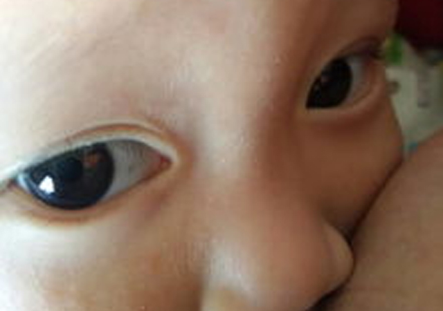 孩子眼白上的黑斑是什么,孩子眼白有很多色斑是什么原因