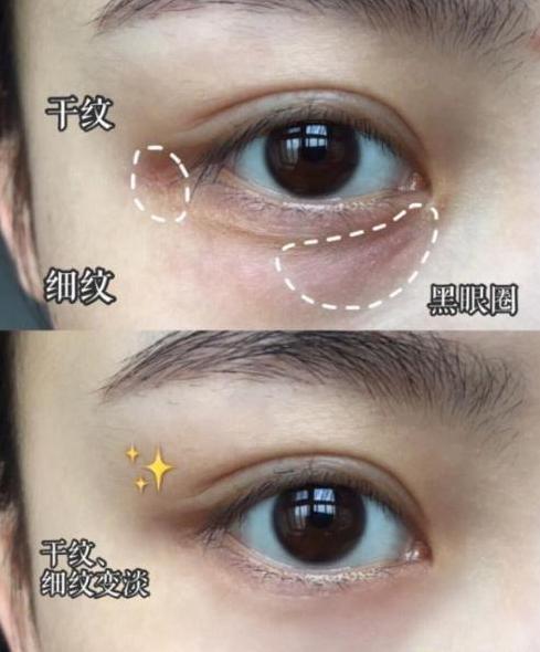 去细纹的电动眼霜,能熨平皱纹的眼霜