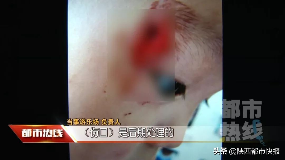 8岁小男孩眼睛被戳伤,3岁孩子游乐场被砸伤