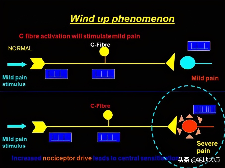 慢性神经痛能治疗好吗,慢性疼痛与心理作用