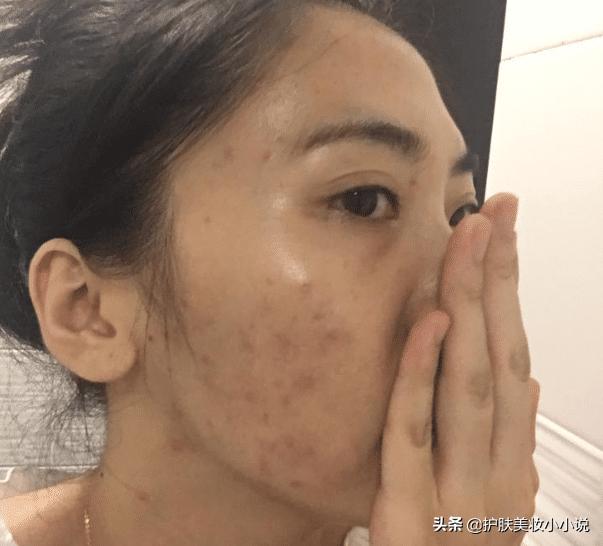 当代护肤的作死行为，难怪少女出现“姨妈脸”