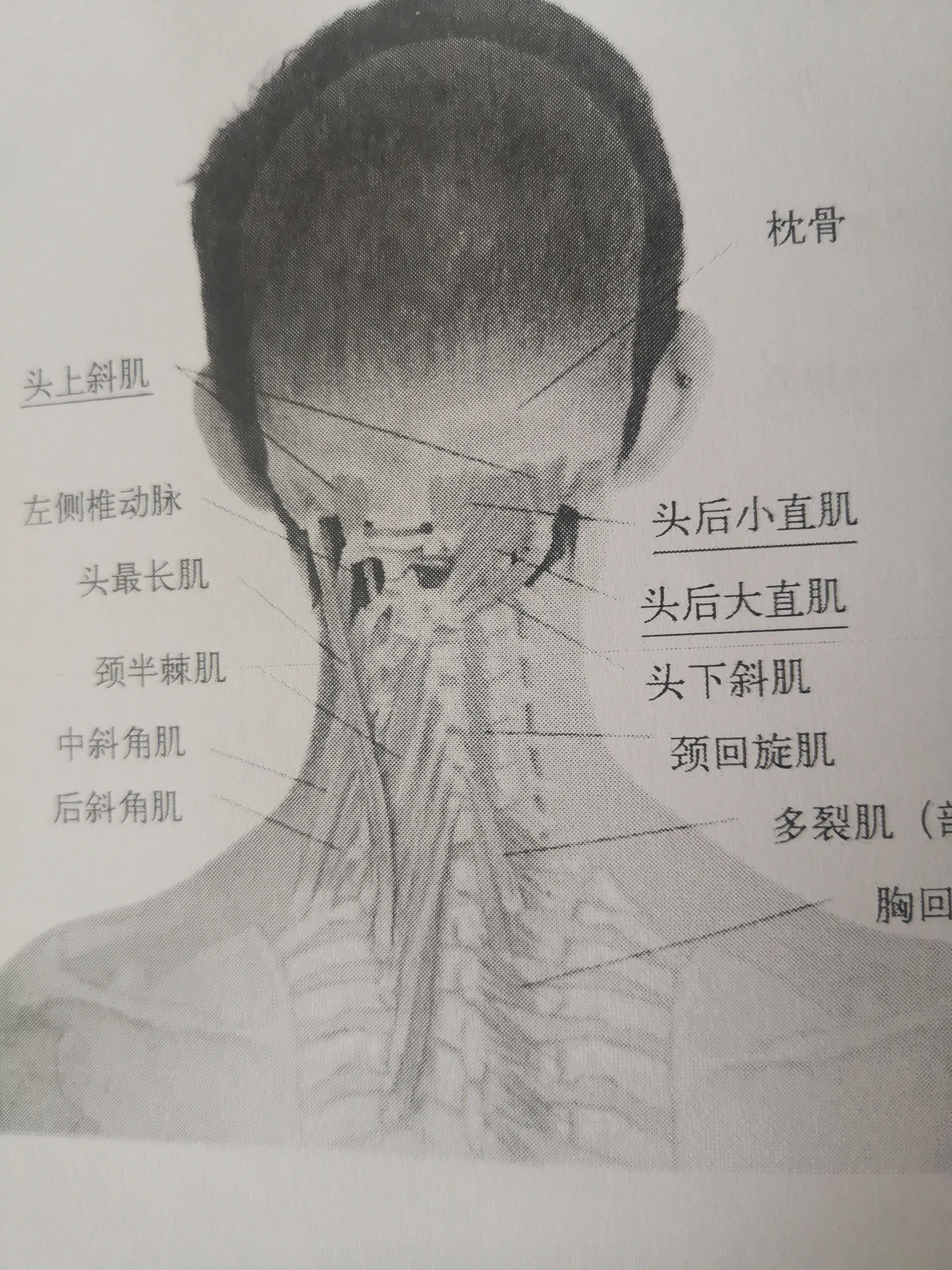 颈椎病导致的视物模糊怎么治疗,一招治颈椎眩晕