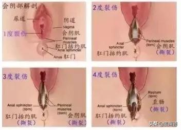 产前必看，十人顺产，减轻撕裂疼痛，方法现在就给你