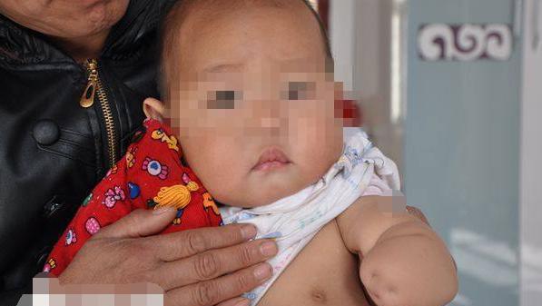 孩子出生时少了1只手，大夫都难以相信，竟是孕妈妈的恶习引起的