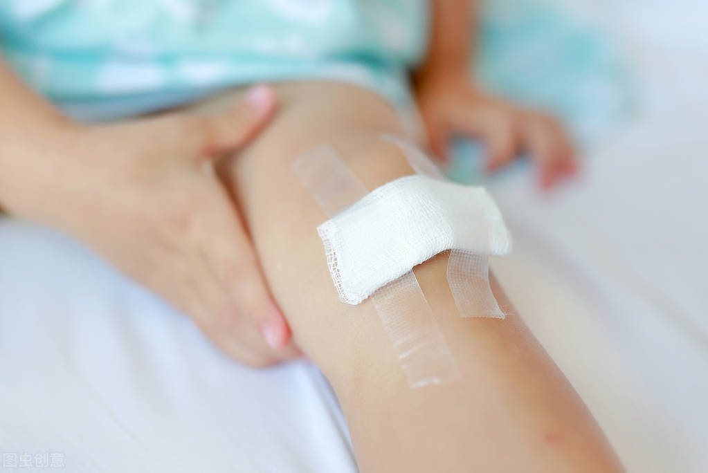 白癜风外伤多久会复发,外伤后如何预防白癜风