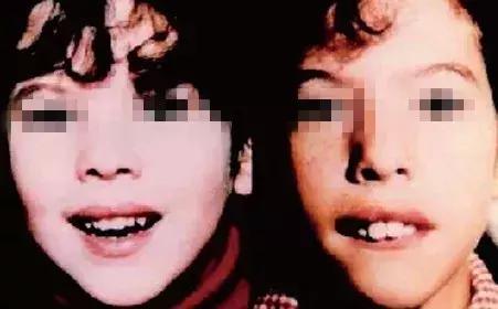 孩子鼻塞严重像打鼾怎么办,孩子鼻塞打鼾怎么缓解