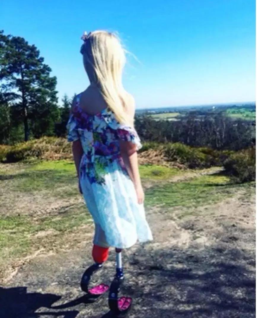 因为卫生棉条被截肢,女星因为卫生巾截肢