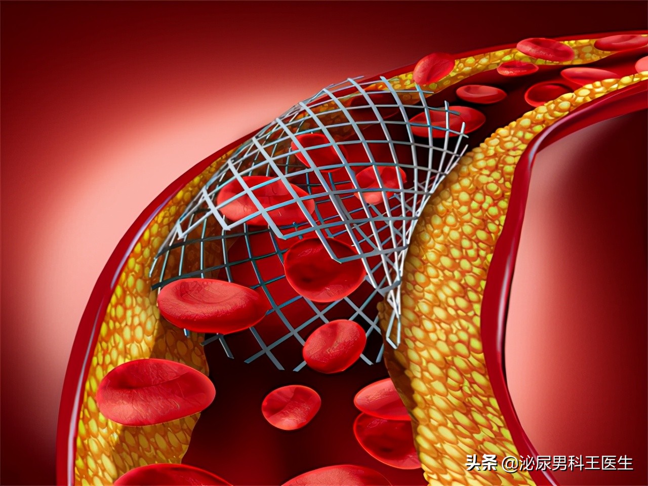 枸橼酸西地那非有没有治早泄功能,枸橼酸西地那非片有治病的功能吗
