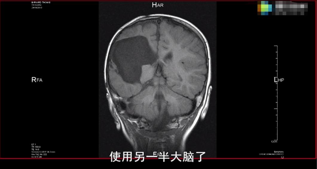 0-1岁婴幼儿养育知识听书,0-3岁宝宝养育全书