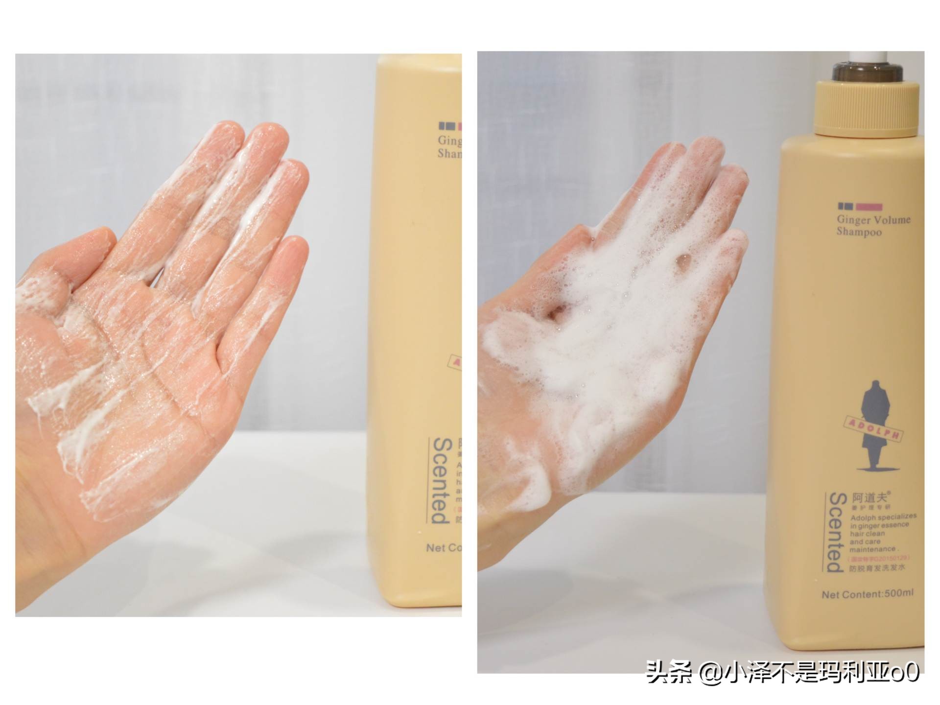 额头秃发际线后移适合什么洗发水,拯救发际线的洗发水