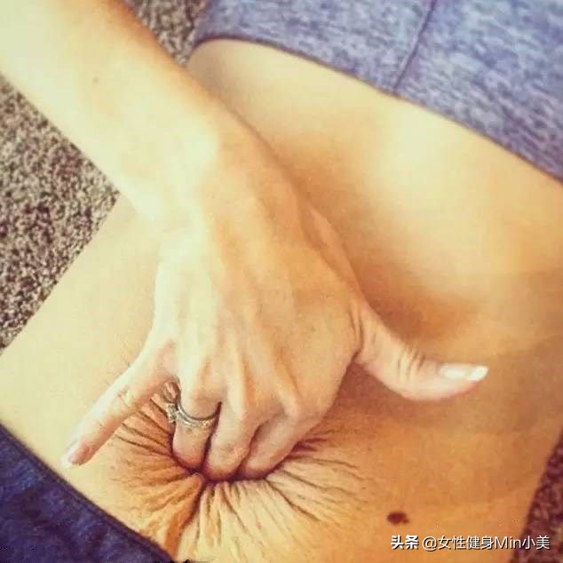 产后腹直肌分离危害动态视频,产后腹直肌分离这些动作都不能做