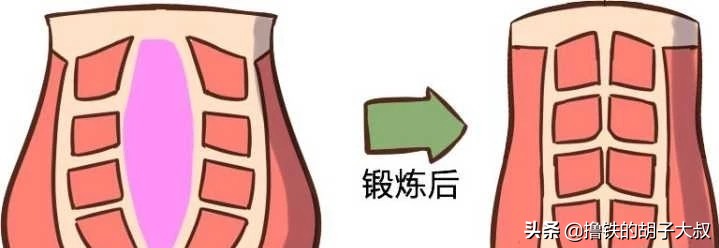 产后腹直肌分离什么症状,产后腹直肌分离如何自测