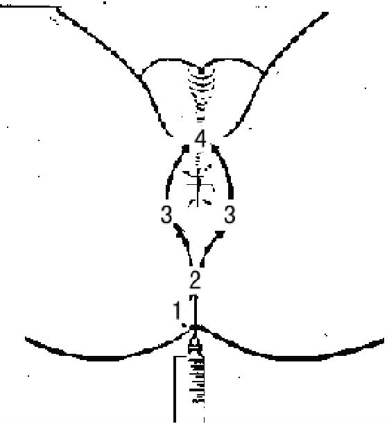 肛诊的具体操作步骤,肛肠病诊疗