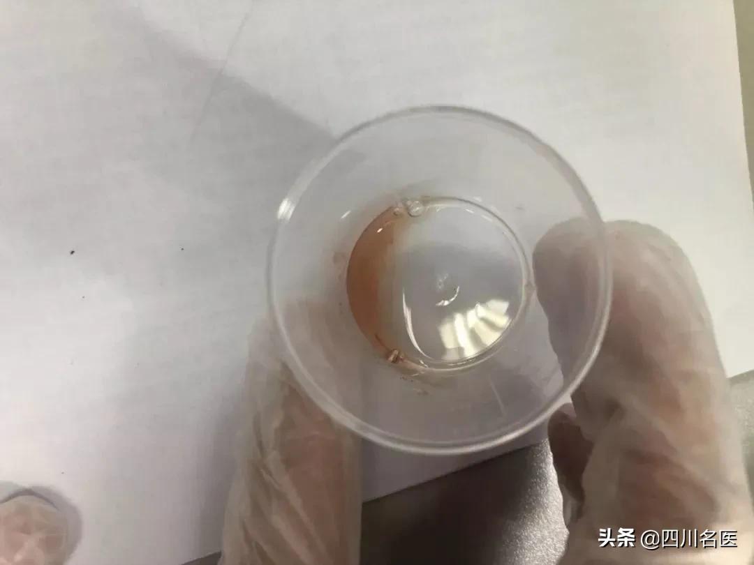 精子是如何产生的百科,精子是不是每天都能生成