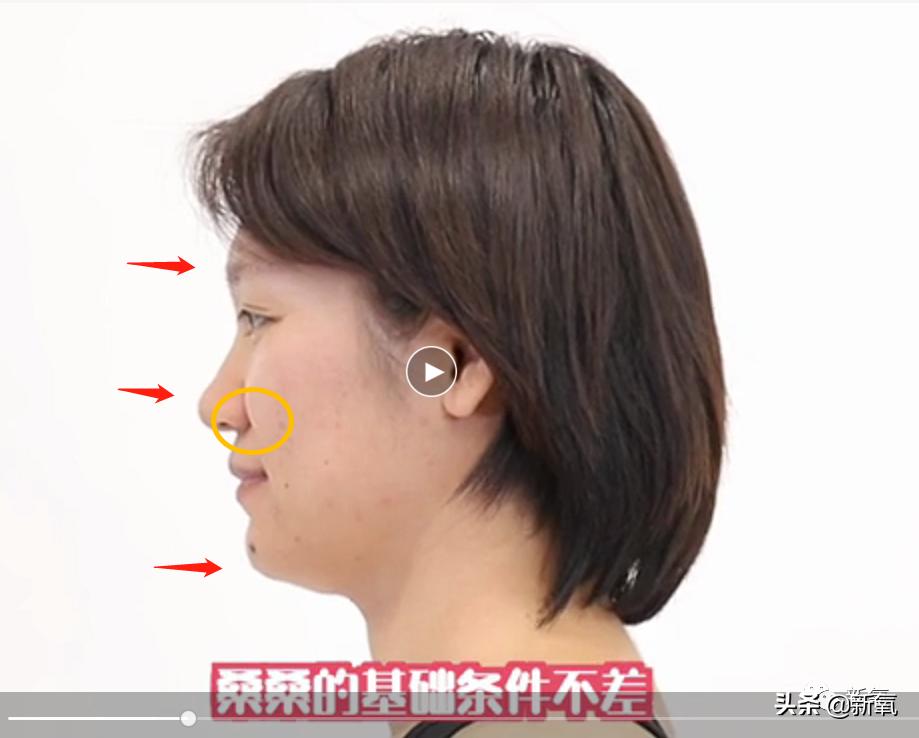 村姑整成鞠婧祎的鼻子变天使,鞠婧祎的鼻子整过吗