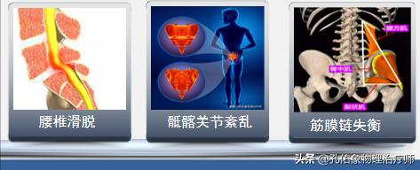 腰椎间盘突出压迫神经腿和屁股疼,腰椎间盘突出压迫神经屁股和腿麻
