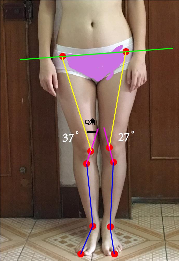 q角评估,q角指标详解图解