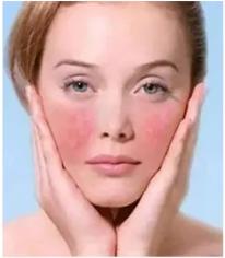 换季脸上起皮的修护面膜,秋季皮肤干燥容易过敏用什么面膜