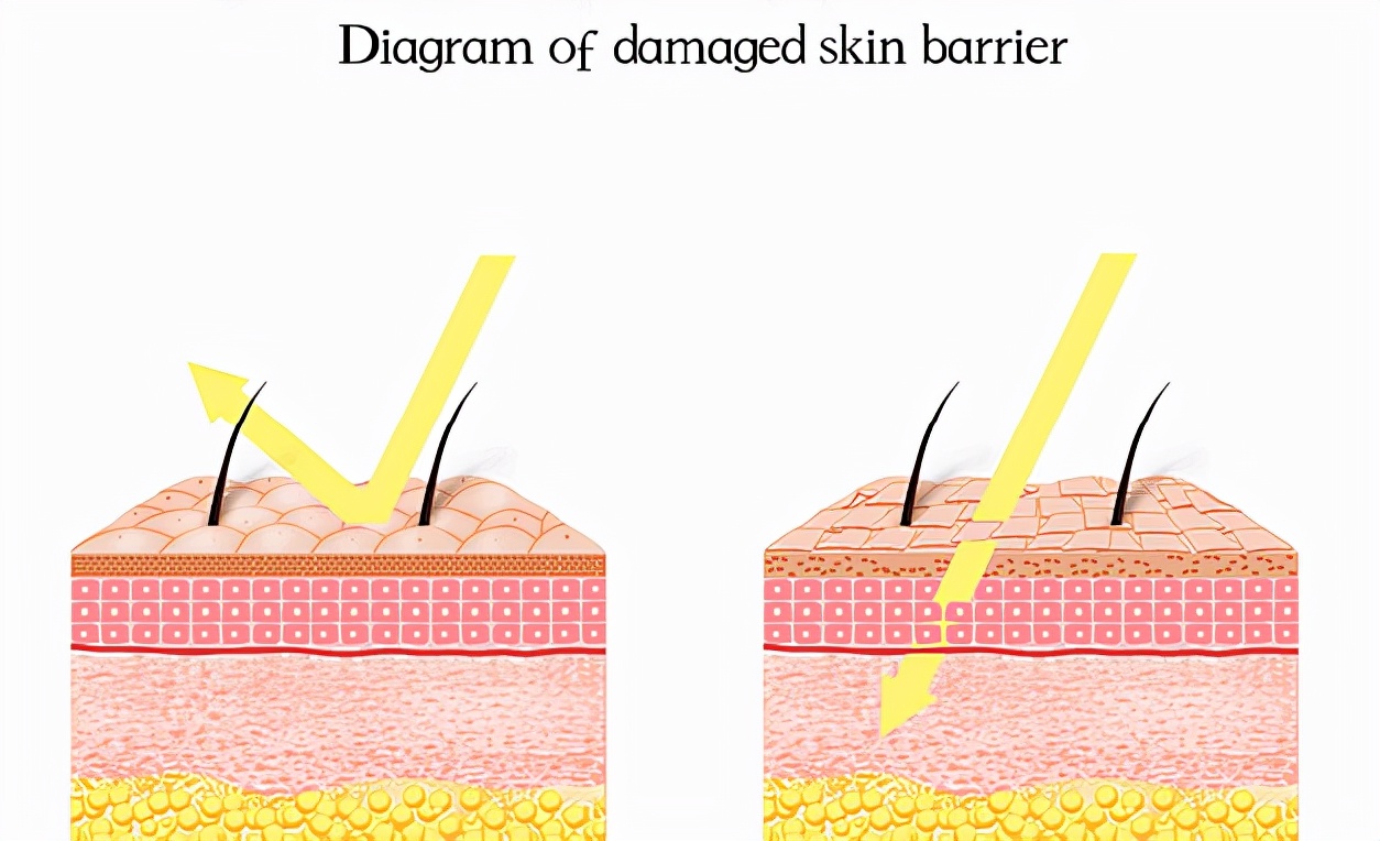 告别敏感红血丝斑点肌肤,告别烂脸拯救敏感肌肤图片