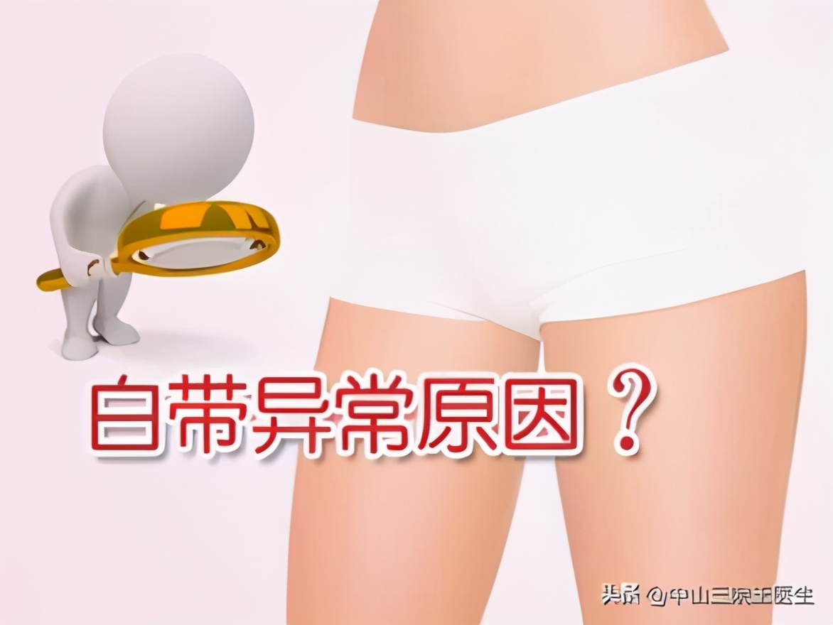 白带健康的晴雨表是什么意思,白带的晴雨表