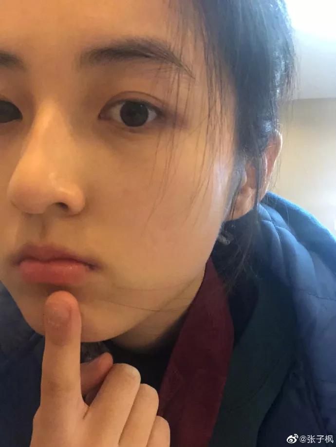 张子枫艺考成绩一鸣惊人,张子枫艺考为什么只考北电