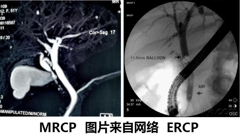 怎么用眼睛识别铁,怎么用火识别锡