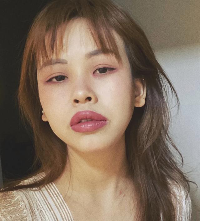 嘴唇厚黑怎么改善,嘴唇很厚而且还翘怎么办