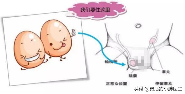 蛋蛋只有一个会影响生育吗,如果只有一个卵囊能去做试管吗