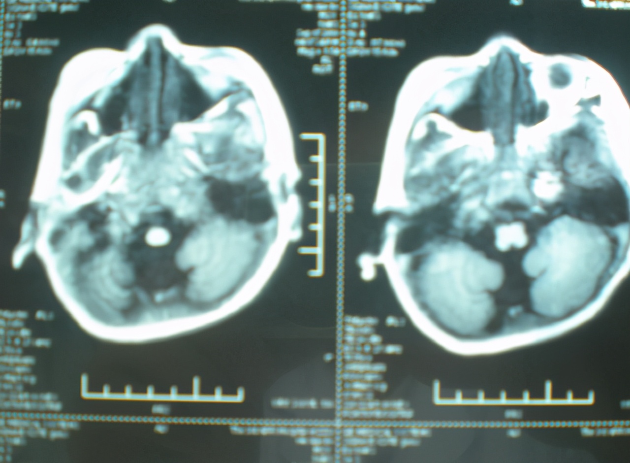 怀孕33周可以检查出胎儿是否健康,女子怀孕30周了