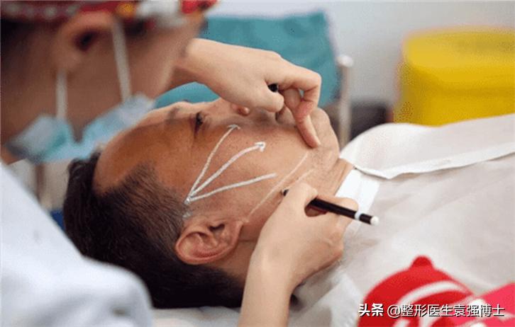 线雕“过时”了？医生说出实情