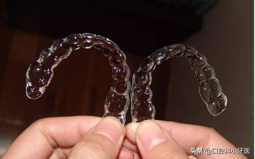 牙医的良心忠告牙齿矫正,别急着牙齿矫正先弄懂这10件事