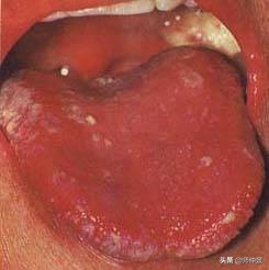 最实用的舌诊图六大舌象,舌诊深入学习书