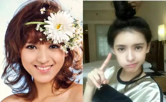 项思醒眼部整容史,项思醒整容了吗