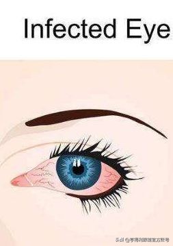 亨得利眼镜无框,亨得利眼镜可以免费换镜片吗