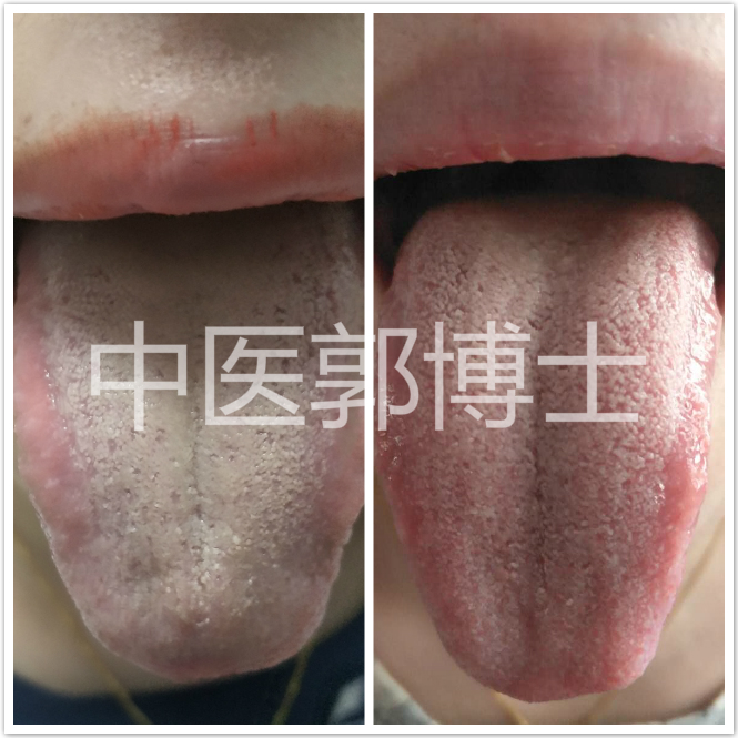 例假推迟5天检测阴性,例假推迟10天需要检查什么