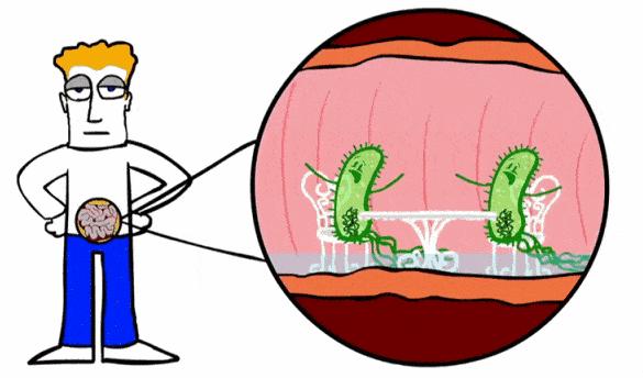 糜烂性胃炎真的是胃烂了嘛,糜烂性胃炎胃食道反流原因