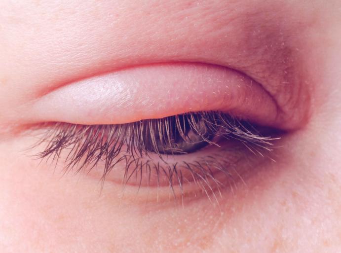 脸上皱纹多按哪个穴位能有作用,按哪个穴位可以去除眼部皱纹