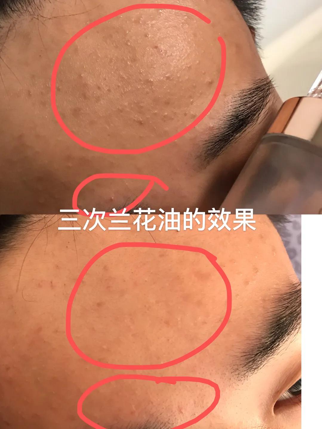 精华油天花板,精华液天花板