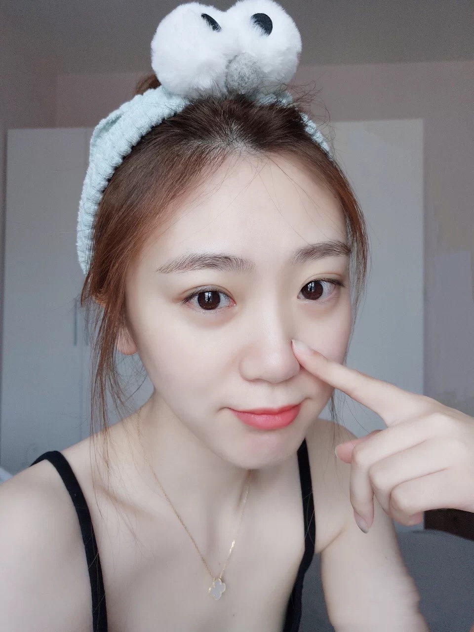 去黑头粉刺和闭口的最好方法,去黑头粉刺闭口最有效的方法