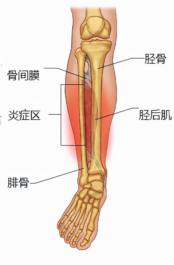 儿童小腿胫骨疼痛怎么回事,孩子胫骨疼不能走路怎么回事