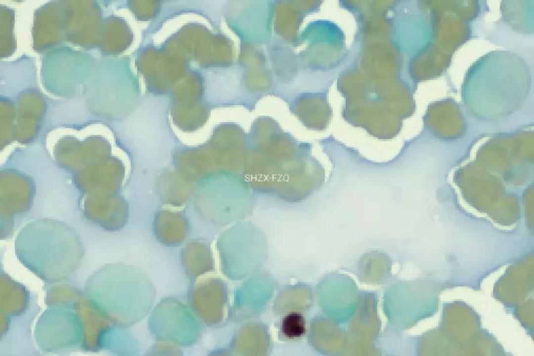 粒单不决问组化?有时还真不一定...