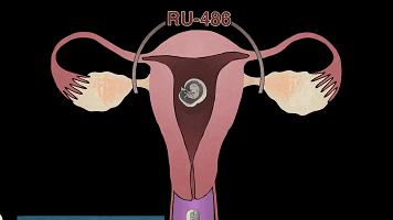 男用避孕药通过试验,网友:叫刘阳打针,半藏森林你不用吃药了