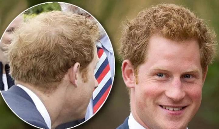 贝克汉姆秃了,贝克汉姆的头发秃了上热搜