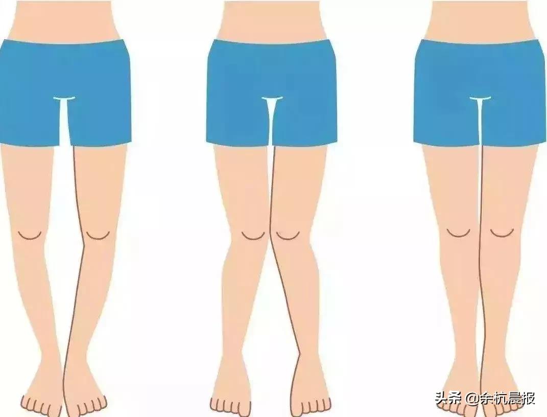 注意！近50%的余杭女性都被这个毛病折磨！这次带来一个好消息！