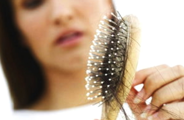 女性甲减是头顶和两边脱发严重吗,甲减脱发是因为缺铁还是因为睾酮