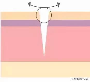 才做完手术为什么更疼,才做完手术需要注意什么