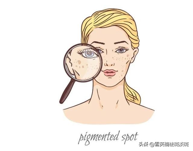 去斑点的最好方法淡斑小妙招,斑点淡斑最好的方法